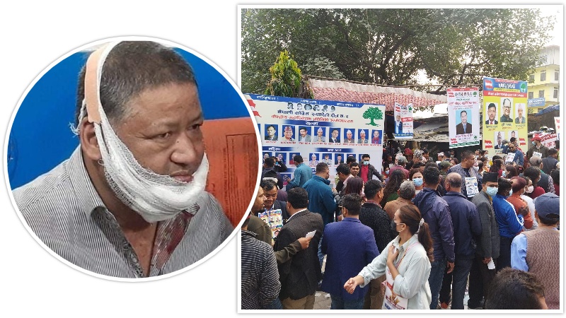 बुटवलमा देउवा-पौडेल पक्षबीच कुटाकुट, घाइतेलाई काठमाडौं पठाइयो