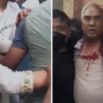 आरजु र शेरबहादुर देउवा जेनजीबाट कुटिएर घाईते